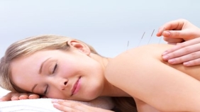 Acupuncture, The Ancient Medicine